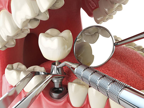 Best Emergency Root Canal Therapy in Mclouth, KS